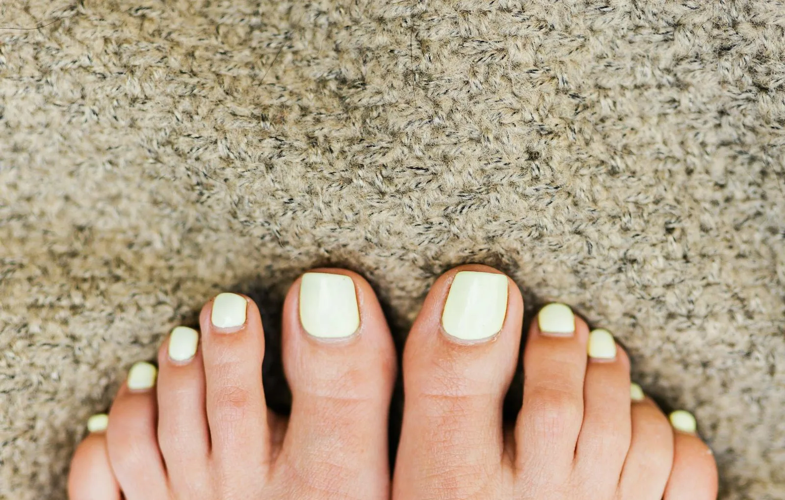 Micose nas unhas